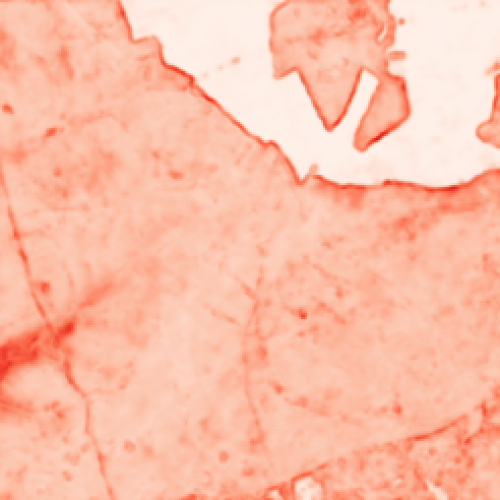 Uncertainty Quantification